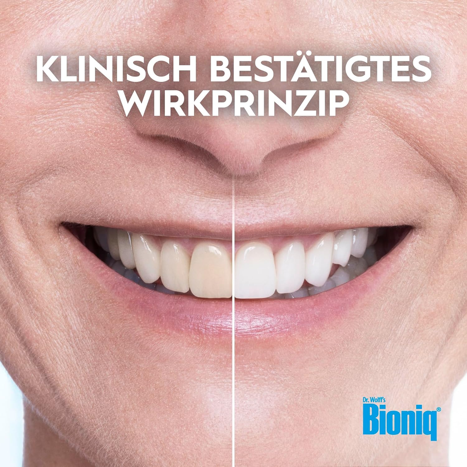 Bioniq® White Filler Zahnpasta - 4 x 75 ml – Sanfte Whitening-Zahncreme mit Hydroxylapatit, schützt und stärkt den Zahnschmelz, für glatte und weiße Zähne, entfernt Verfärbungen schonend, ohne Fluorid